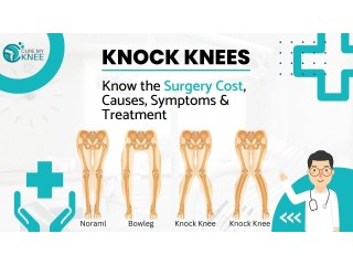 Knock Knee Surgery Cost