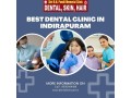 best-dentist-in-indirapuram-small-0