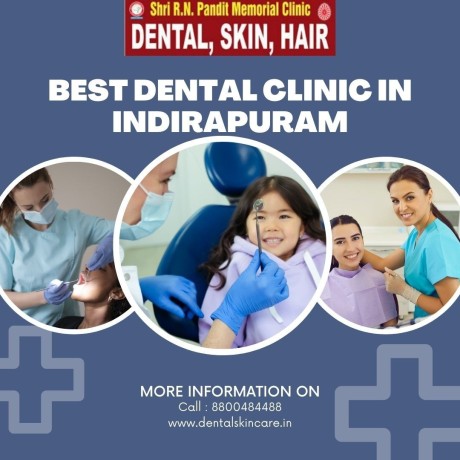 best-dentist-in-indirapuram-big-0