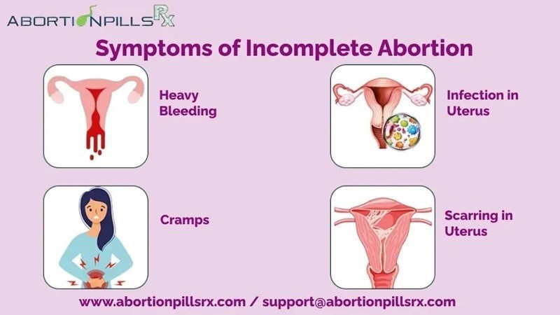 what-are-symptoms-of-incomplete-abortion-after-taking-mtp-kit-big-0